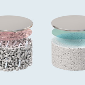 Links: Poröser Festelektrolyt, durch den Dendriten (grau) bis zur Lithiumoberfläche (silbern) vordringen; geschützt nur durch eine Grenzschicht (rosa). Rechts: Dicht gesinterter Elektrolyt mit LiF-Beschichtung (blau), die Dendriten stoppt.